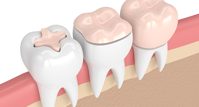 Restorative Dentistry