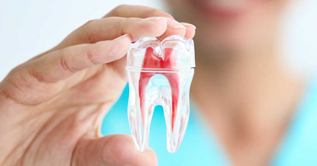 root canal treatments carried out