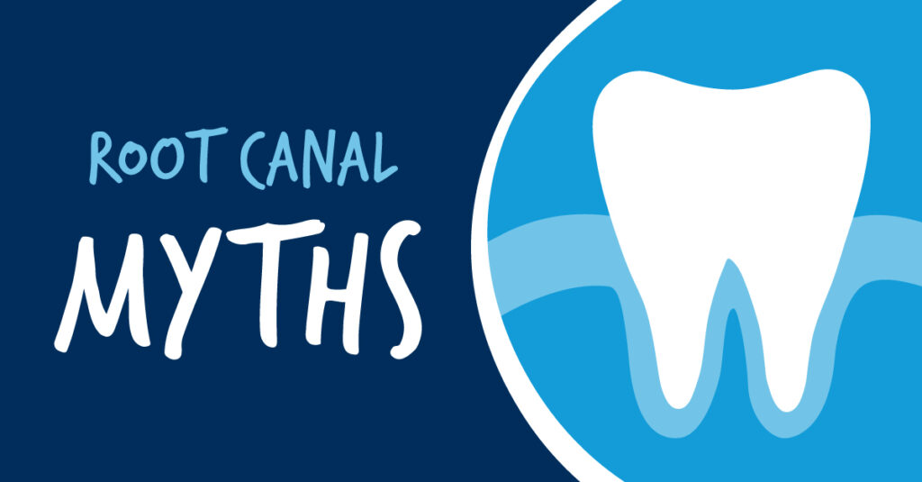 Myths About Root Canal Therapy