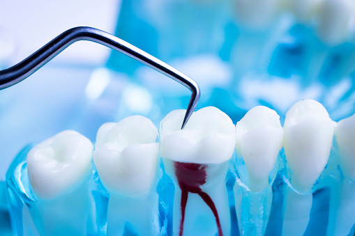 Importance of Finding the Right Dentist