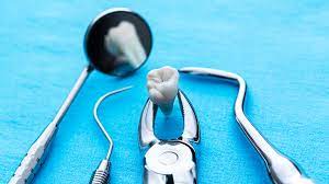 Oral Surgery Burnaby
