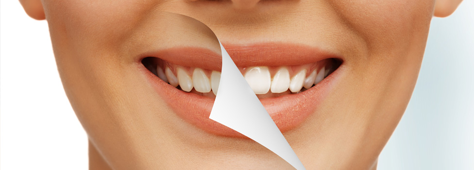 Benefits of Cosmetic Dentistry in Burnaby