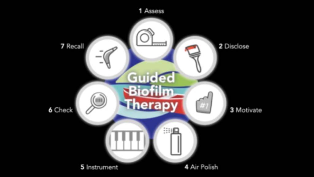 burnaby-dentist-guided-bio-therapy