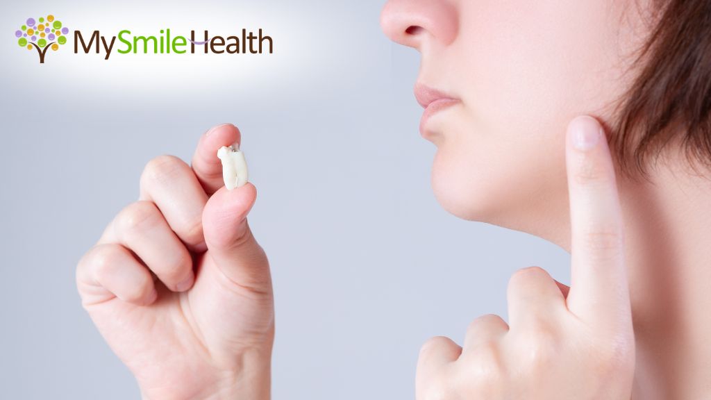 burnaby-dentist-wisdom-tooth-extraction